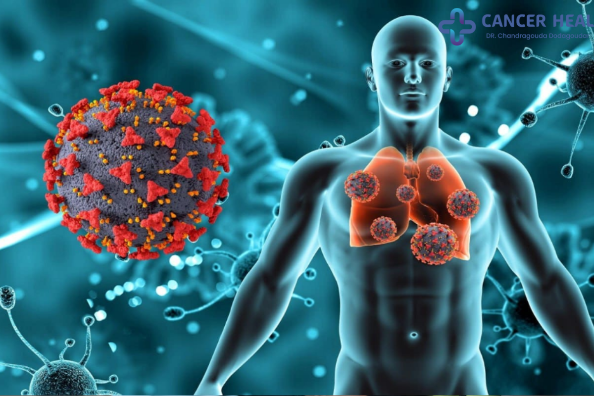 Immunotherapy treatment for cancer