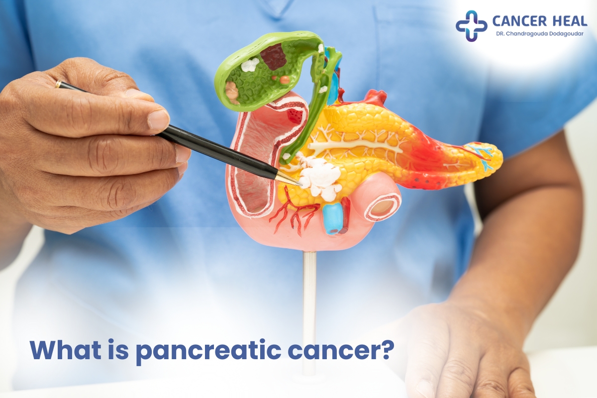 Pancreatic Cancer Specialist in Delhi NCR, India