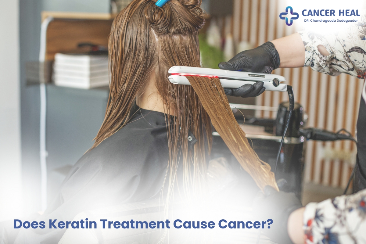 Causes Cancer Specialist in Delhi