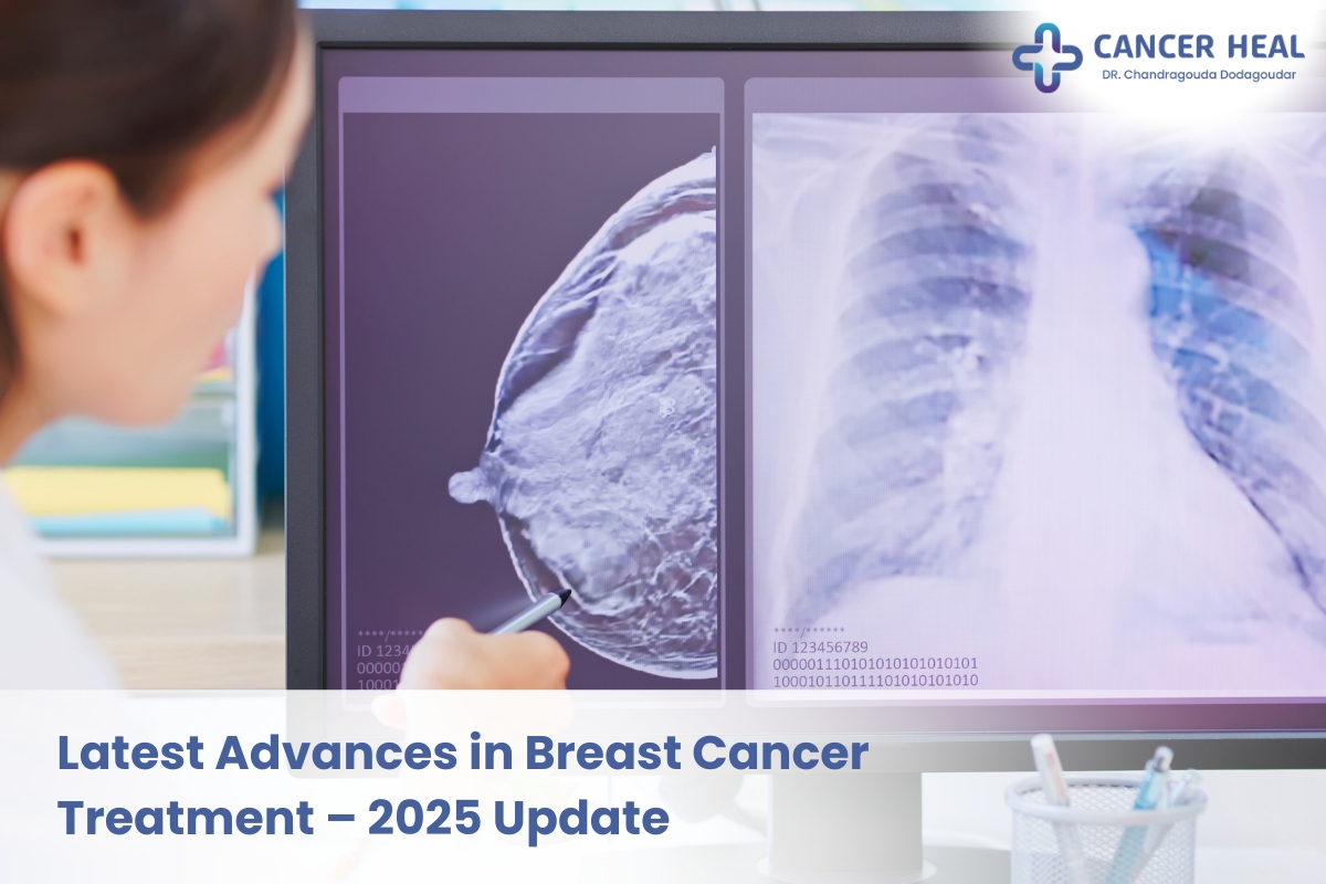 Latest advances in breast cancer treatment 2025 including targeted therapy, immunotherapy, and precision oncology care