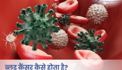 blood cancer causes symptoms and treatment explained