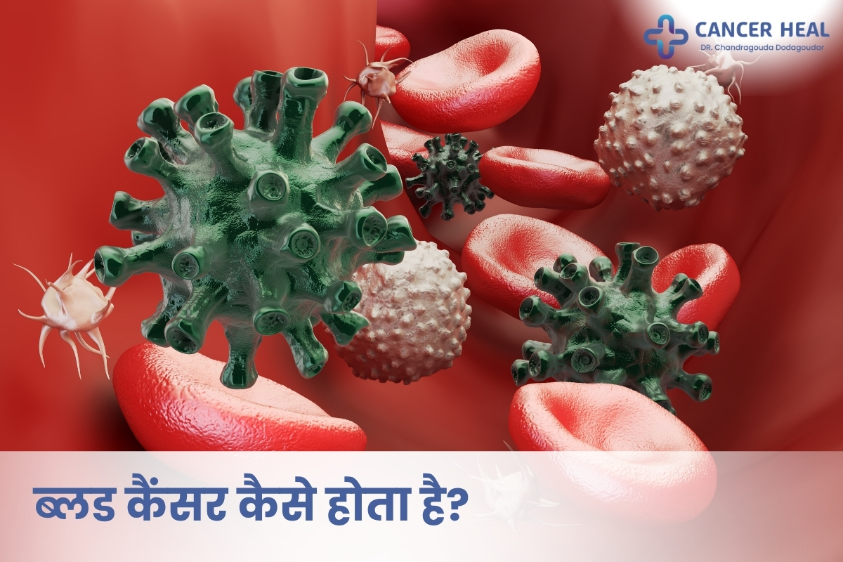 blood cancer causes symptoms and treatment explained