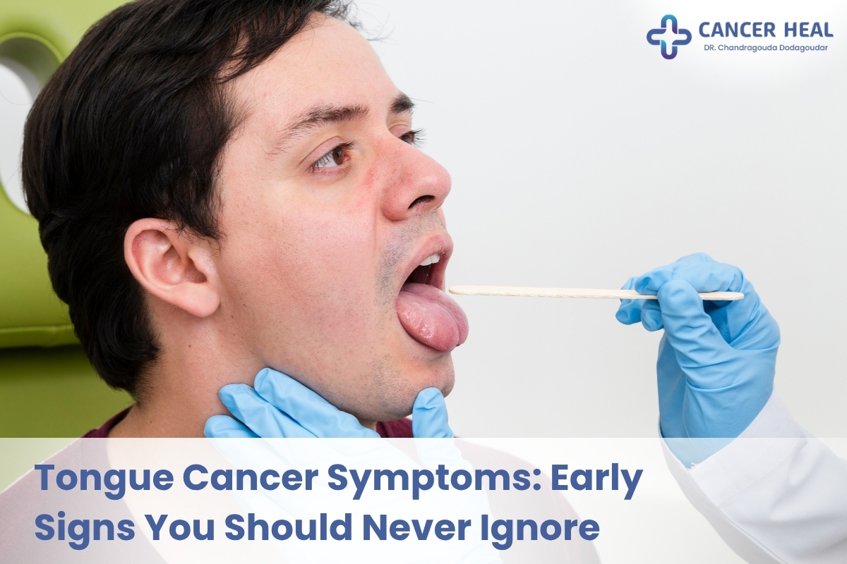 Tongue Cancer Symptoms & Warning Signs Explained
