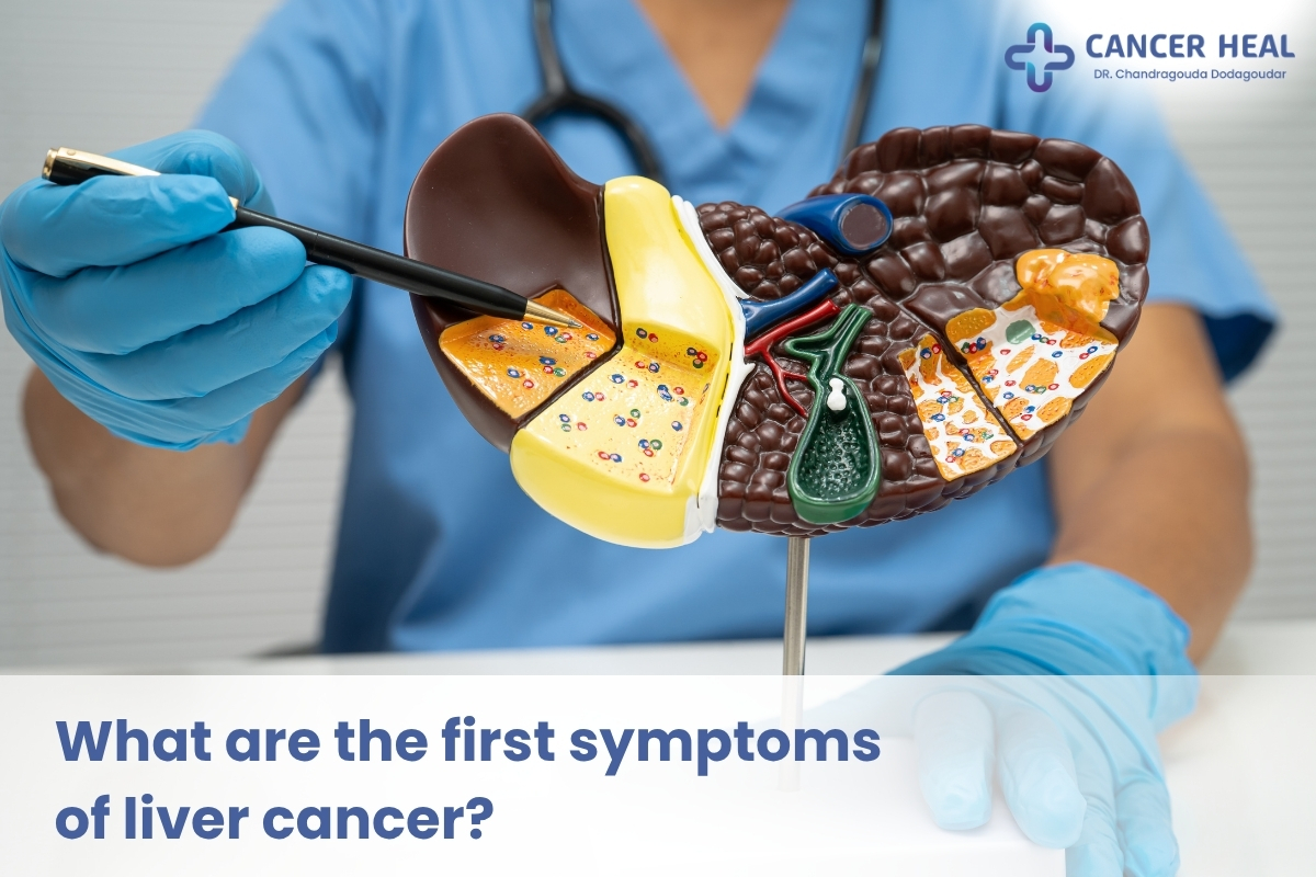 first stage liver cancer symptoms