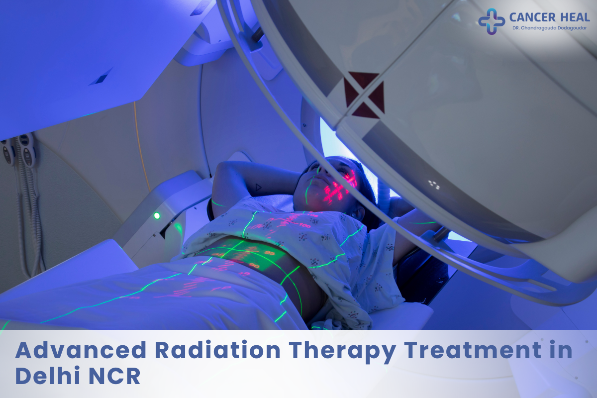 Advanced Radiation Therapy Treatment in Delhi NCR | Dr. Deepika Chauhan