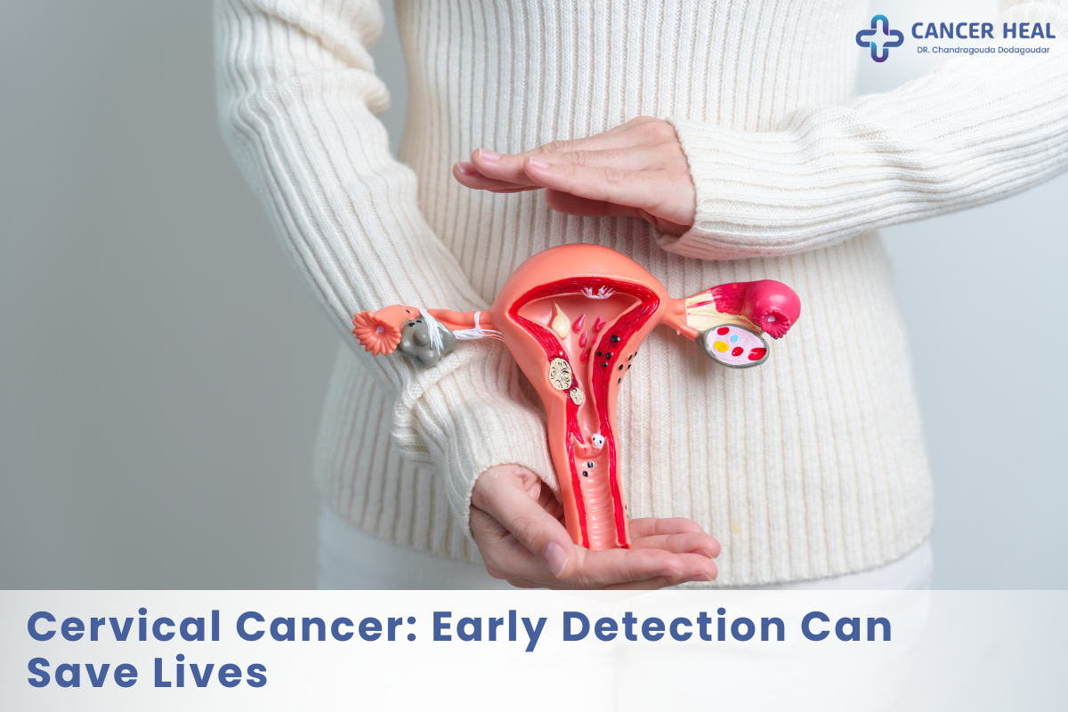 Cervical Cancer: Early Detection Can Save Lives